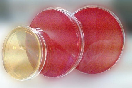 Salmonella Shigella agar (SS): ສື່ກາງທີ່ສໍາຄັນສໍາລັບການໂດດດ່ຽວຂອງເຊື້ອພະຍາດ