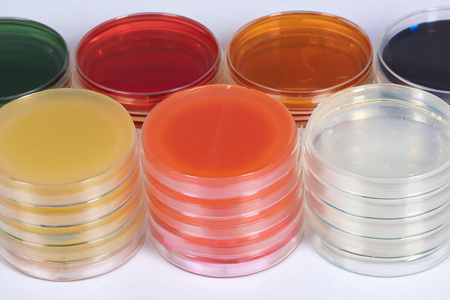 Triple Sugon agar agar (TSI): ຄວາມແຕກຕ່າງທີ່ຖືກຕ້ອງຂອງ Bacilli ກັບ Babio