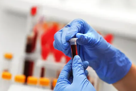 BABIO ເປີດຕົວການທົດສອບການຖືພາໄວຂອງ Fluorescence Bovine