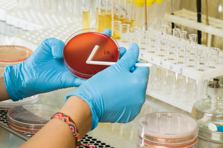 BABIO's MacConkey Agar Medium - ການໂດດດ່ຽວແບບພິເສດສໍາລັບການວິນິດໄສຈຸລິນຊີທົ່ວໂລກ