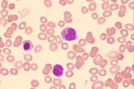 BABIO Disposable Sterile Cytology Cervical Brush ສໍາລັບການກວດສຸຂະພາບຂອງແມ່ຍິງທີ່ເຊື່ອຖືໄດ້
